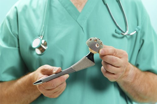 Hip Replacement Surgeon shows hip organ