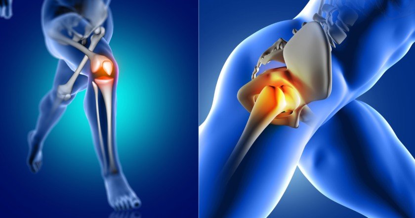 Joint Replacement In Nagpur