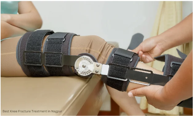 Knee Fracture In Nagpur